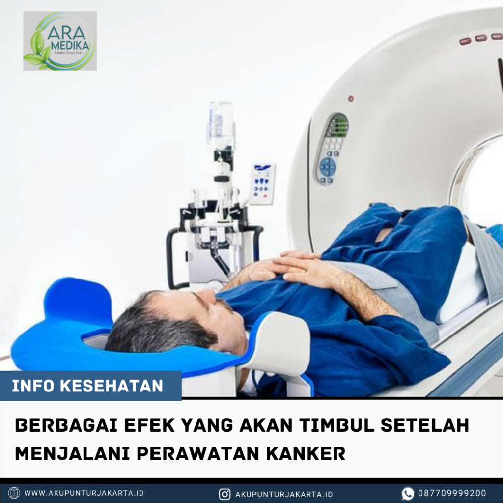 TERAPI AKUPUNTUR PADA PASIEN KANKER 08770-9999-200