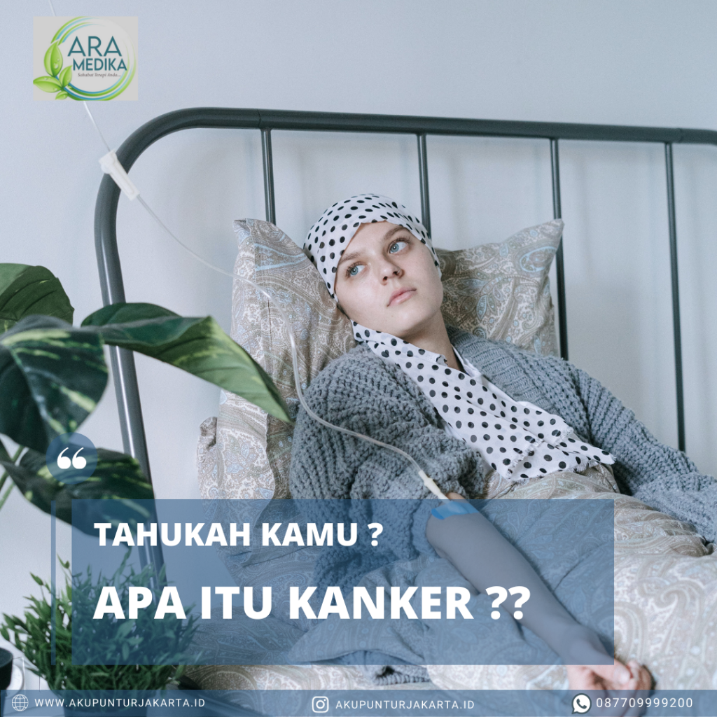 TERAPI AKUPUNTUR PADA PASIEN KANKER 08770-9999-200