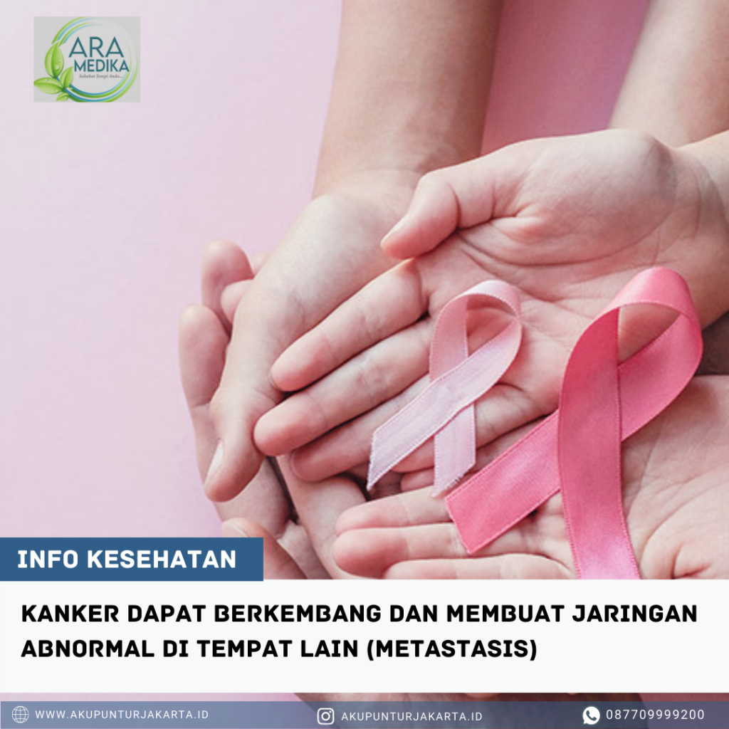 TERAPI AKUPUNTUR PADA PASIEN KANKER 08770-9999-200