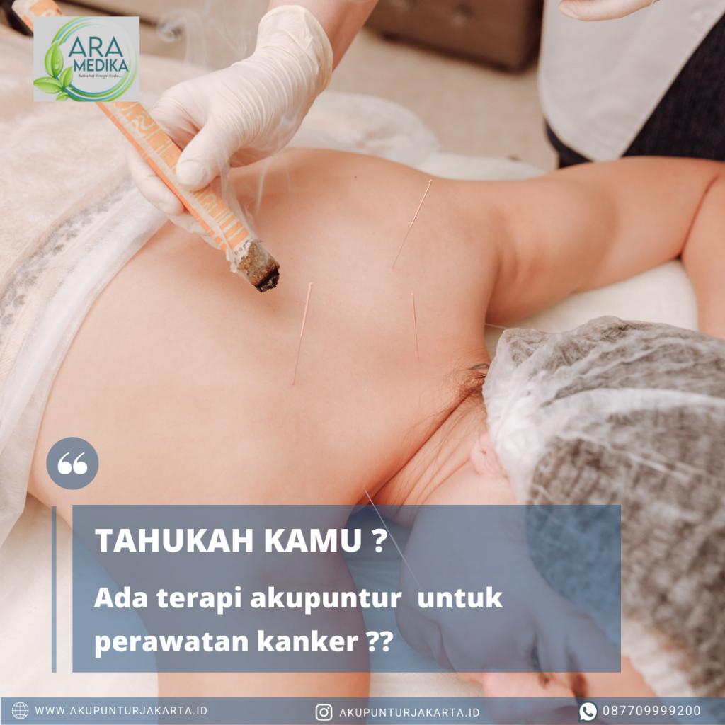TERAPI AKUPUNTUR PADA PASIEN KANKER 08770-9999-200